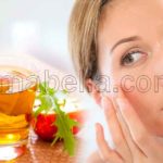 mascarilla de vinagre de manzana para el acné